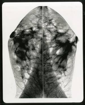 view Healthy breast mammogram, artwork