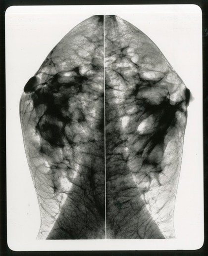 Healthy breast mammogram, artwork