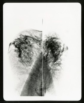 Healthy breast mammogram, artwork