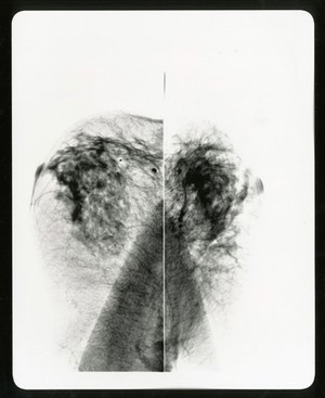 view Healthy breast mammogram, artwork