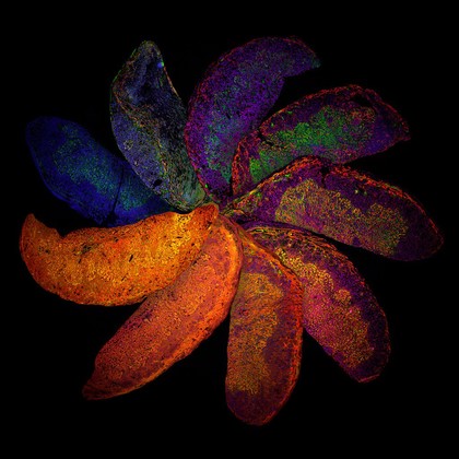 The Placenta Rainbow : immune system regulation of placental development, mouse.