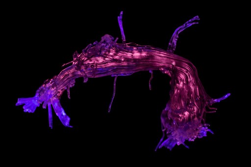 3D-printed reconstruction of the arcuate fasciculus