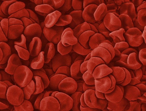 Blood Cells, SEM