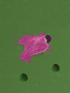 Human oral squamous cell carcinoma cell