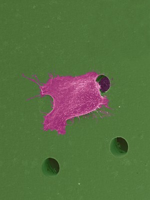 view Human oral squamous cell carcinoma cell