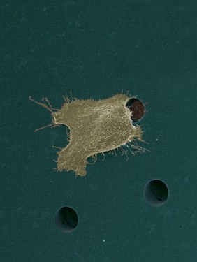 Human oral squamous cell carcinoma cell