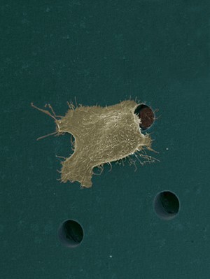 view Human oral squamous cell carcinoma cell