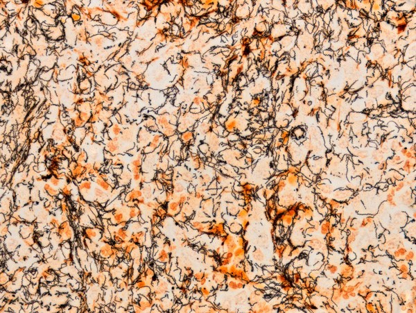 Spirochete presentation in inguinal lymph node section