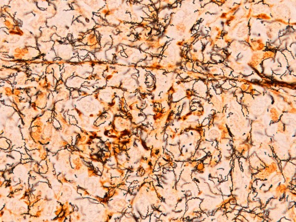 Spirochete presentation in inguinal lymph node section