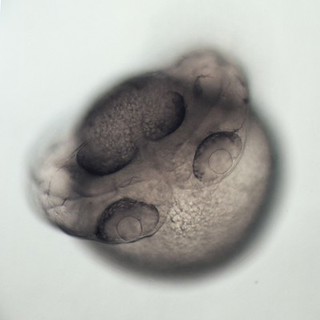 A two day-old twin zebrafish embryo with one shared yolk and tail but two fully developed heads touching each other at the nose.