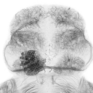 view Dorsal view of the forebrain of a wild-type zebrafish embryo