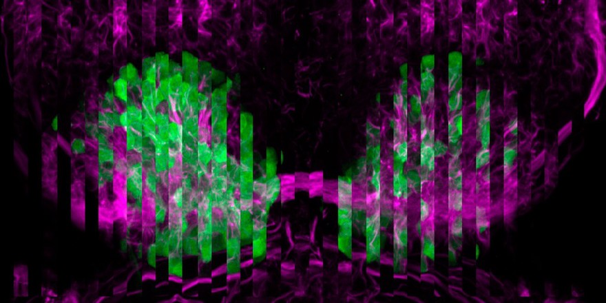 Habenular nucleus of zebrafish, composition