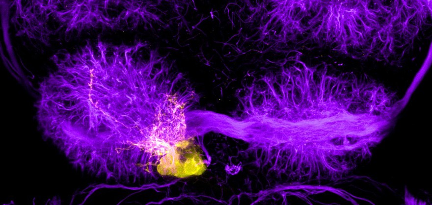 Epithalamus of developing zebrafish