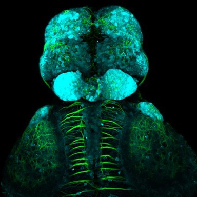 Glutamatergic neurons in the zebrafish forebrain