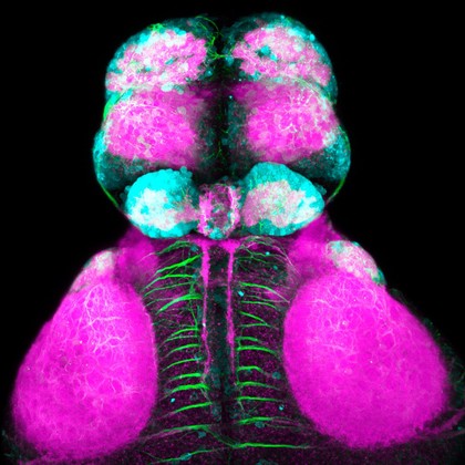 Glutamatergic neurons in the zebrafish forebrain