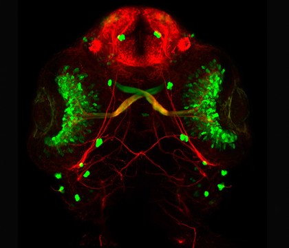 Eye development, zebrafish