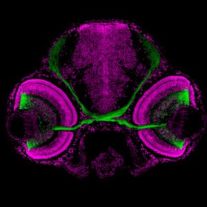 view Transverse section of brain and eyes, Zebrafish model