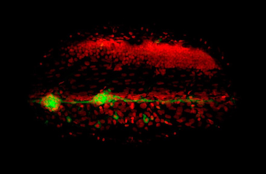 Zebrafish posterior lateral line development