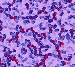 view Group A Streptococci are a species of gram-positive bacteria responsible for causing a number of pyogenic (pus-producing) infections including impetigo, scarlet fever and pneumonia. Further fatal complications arising from infection include the development of meningitis and sepsis.