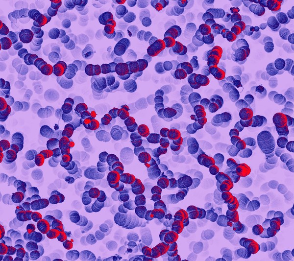 Group A Streptococci are a species of gram-positive bacteria responsible for causing a number of pyogenic (pus-producing) infections including impetigo, scarlet fever and pneumonia. Further fatal complications arising from infection include the development of meningitis and sepsis.