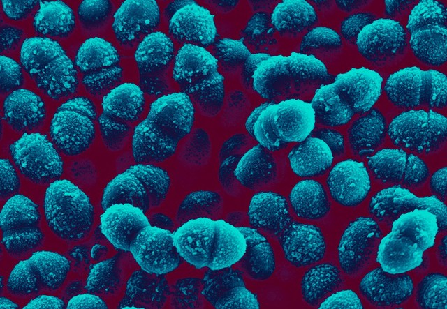 Group A Streptococci are a species of gram-positive bacteria responsible for causing a number of pyogenic (pus-producing) infections including impetigo, scarlet fever and pneumonia. Further fatal complications arising from infection include the development of meningitis and sepsis.
