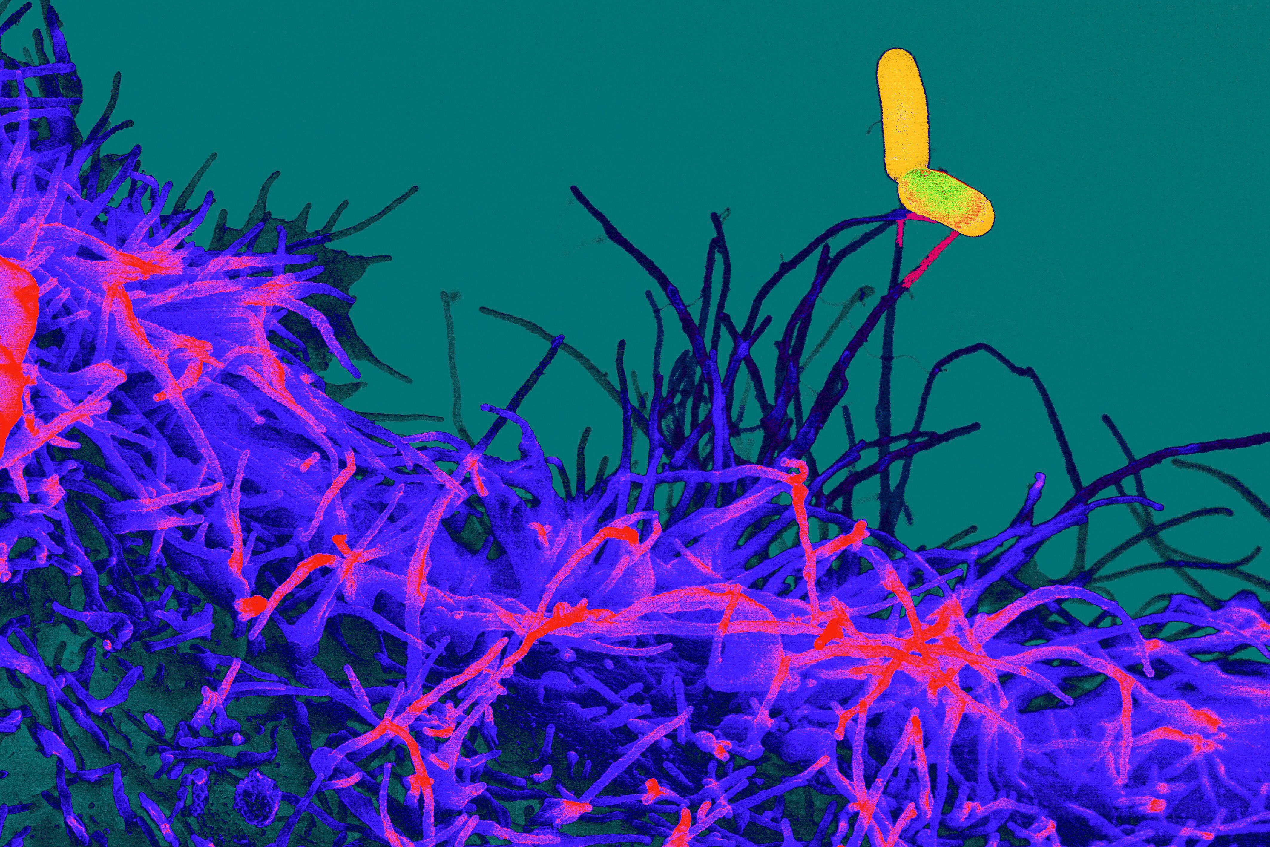 Salmonella detection by human epithelial type-2 cell ...