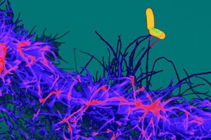 view Salmonella detection by human epithelial type-2 cell