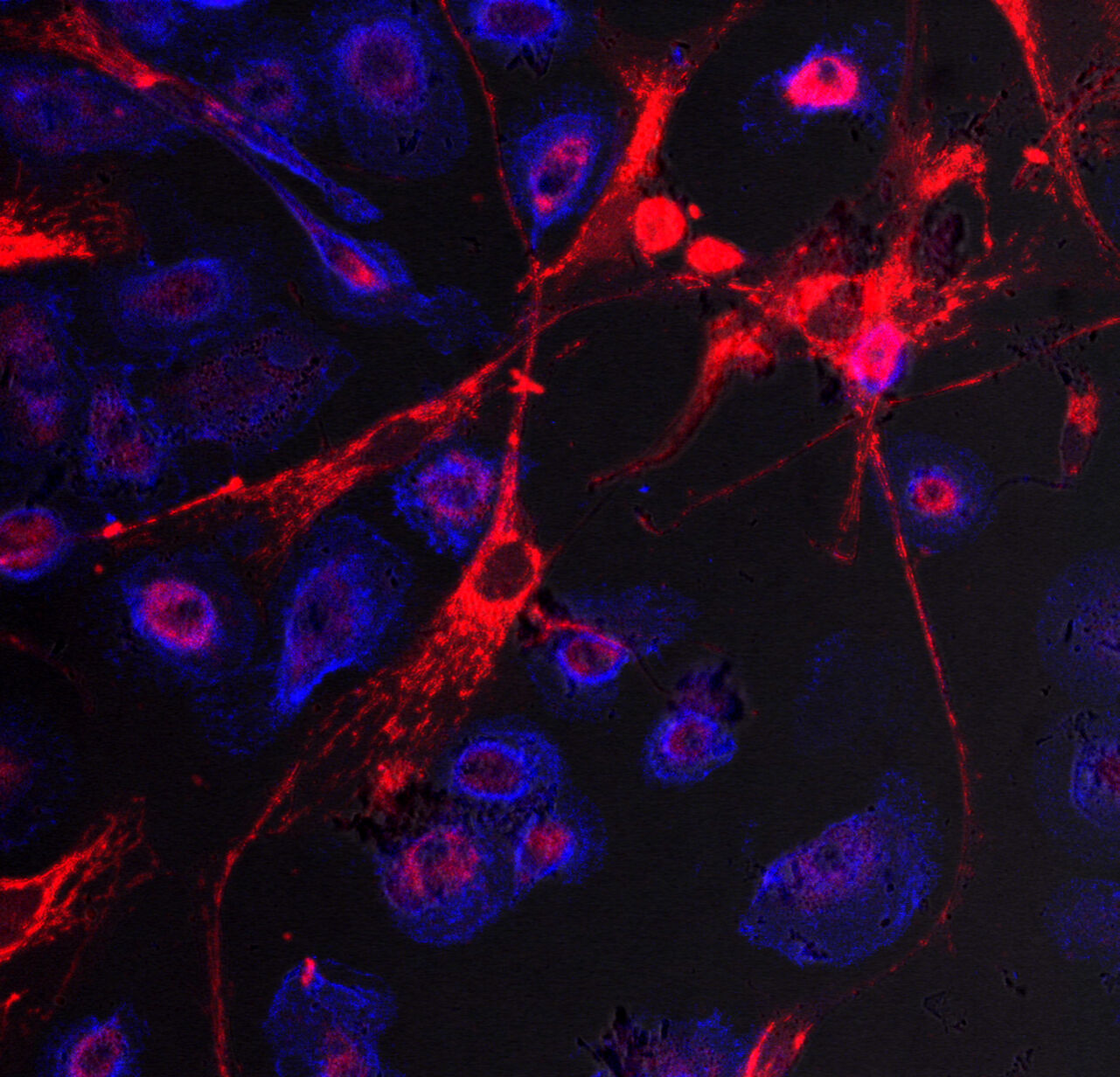 Stem cell transfer of mitochondria, by Queen's University Belfast