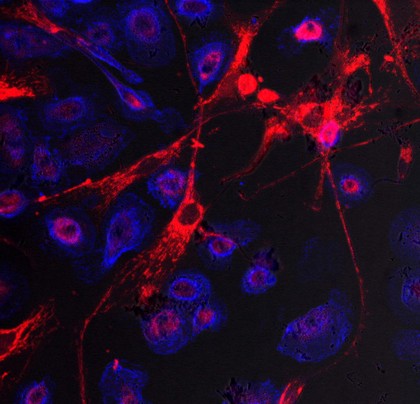 Stem cell transfer of mitochondria