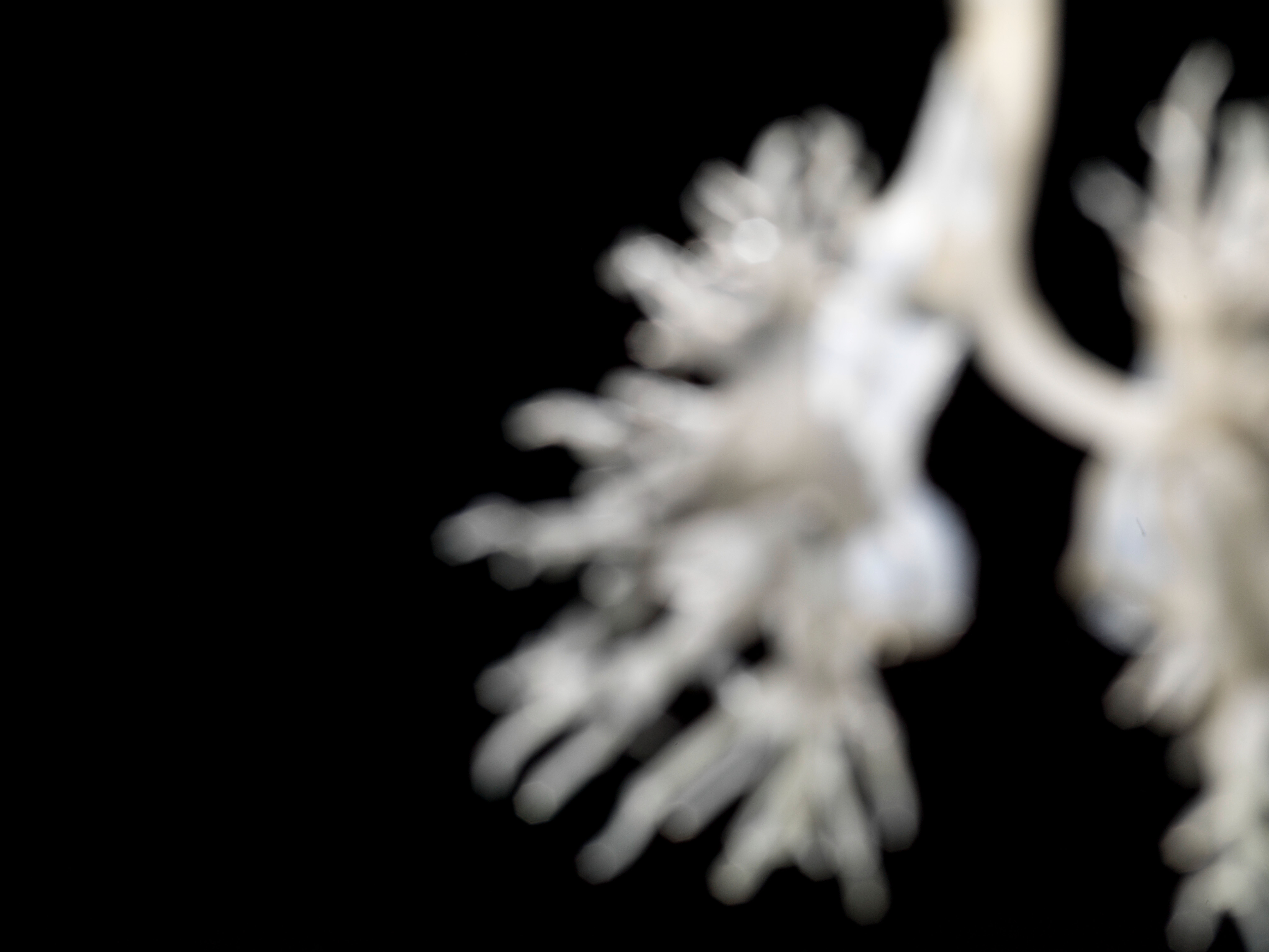 Internal Structure Of The Lungs 3d Printed Plastic Wellcome Collection
