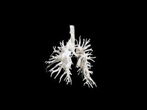 view Internal structure of the lungs, 3D printed plastic