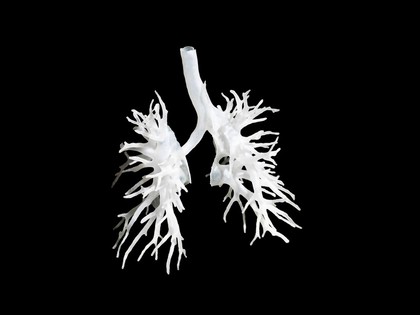 Internal structure of the lungs, 3D printed plastic