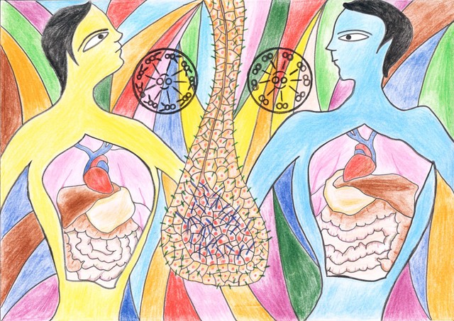 Situs inversus, illustration
