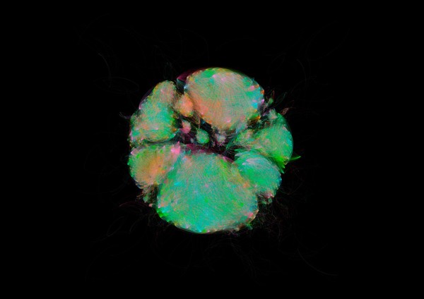 Bacterial microbiome mapping, bioartistic experiment