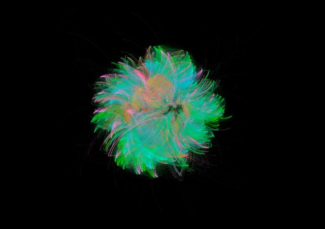 Bacterial microbiome mapping, bioartistic experiment