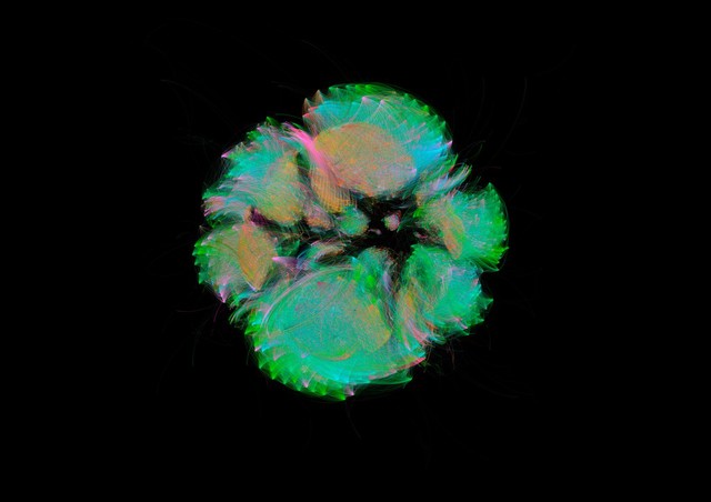 Bacterial microbiome mapping, bioartistic experiment