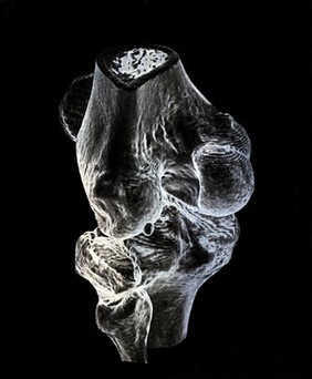 X-ray of a knee joint printed on coated aluminium, artwork