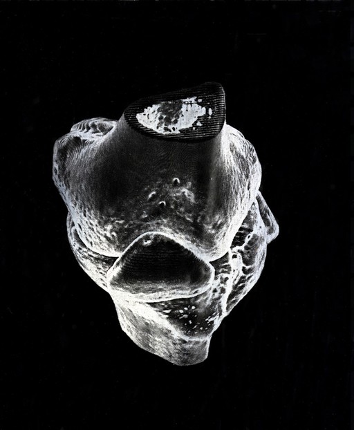 X-ray of a knee joint printed on coated aluminium, artwork