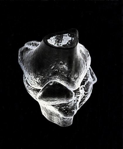 X-ray of a knee joint printed on coated aluminium, artwork