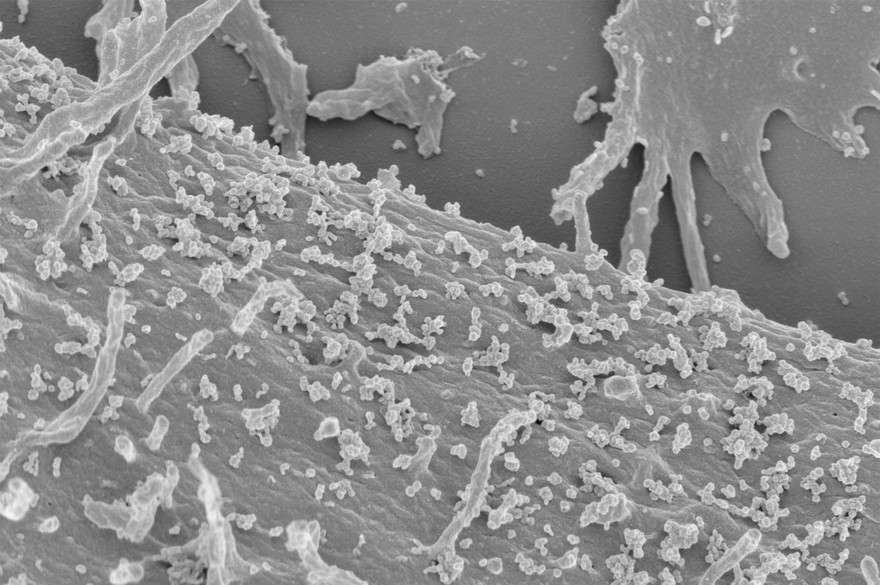 Exosomes on surface of HeLa cell