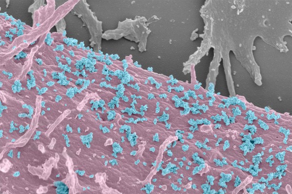 Exosomes on surface of HeLa cell