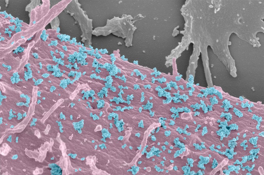 Exosomes on surface of HeLa cell