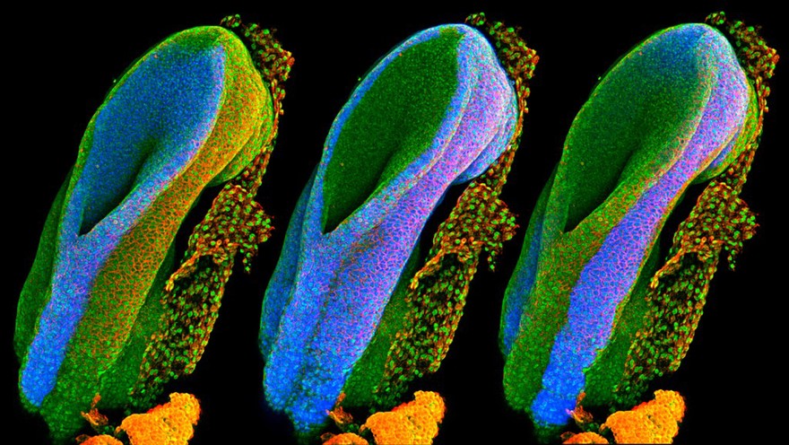 Mouse embryonic posterior neuropore, confocal image.
