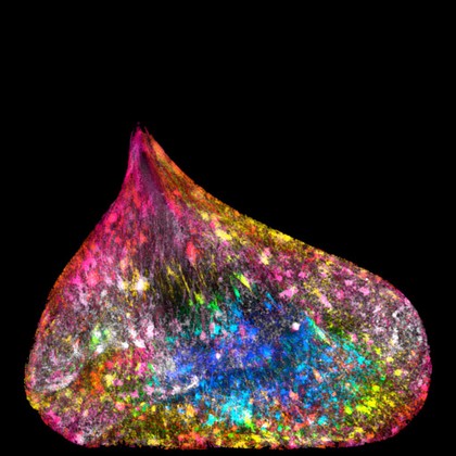 Misreplication of DNA in a human fibroblast nucleus.