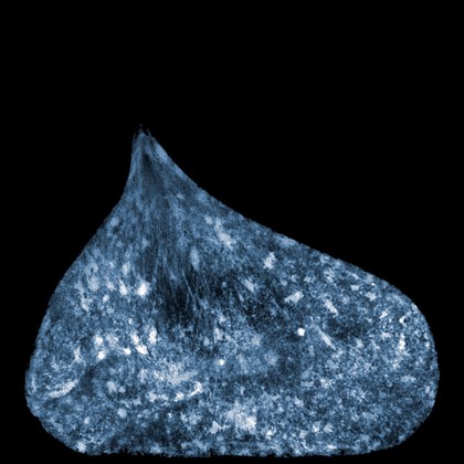 Misreplication of DNA in human fibroblast nucleus