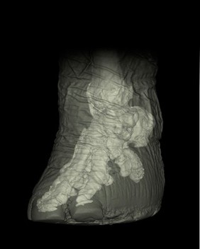 Reconstructed CT scan of elephant foot