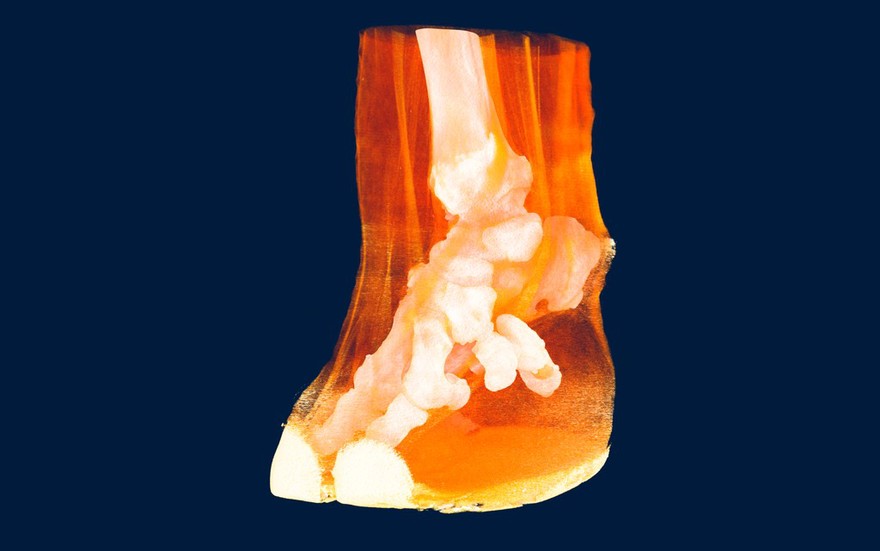 Reconstructed CT scan of elephant foot