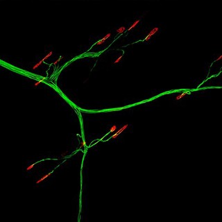 Mouse neuromuscular junctions