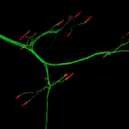Mouse neuromuscular junctions