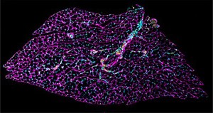 view Transverse section through mouse soleus muscle